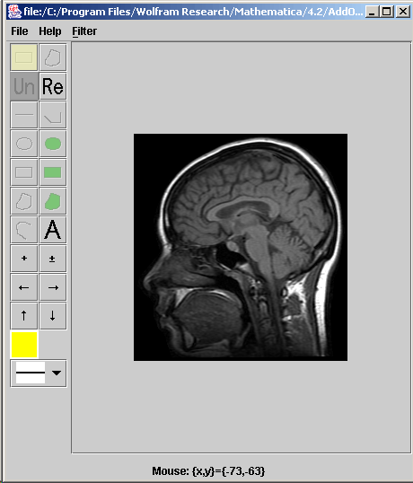[Graphics:../HTMLFiles/index_339.gif]