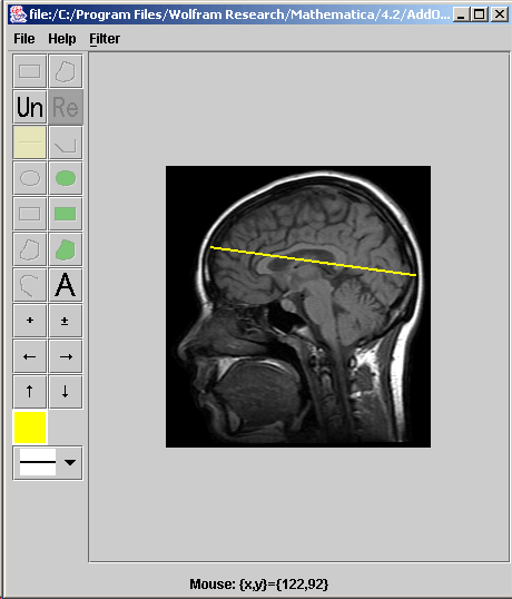 [Graphics:../HTMLFiles/index_343.gif]