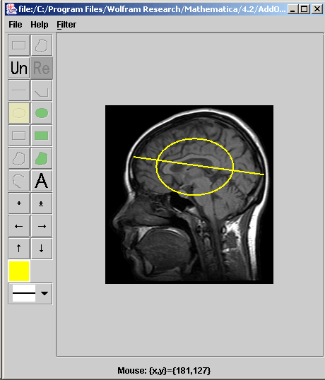 [Graphics:../HTMLFiles/index_357.gif]