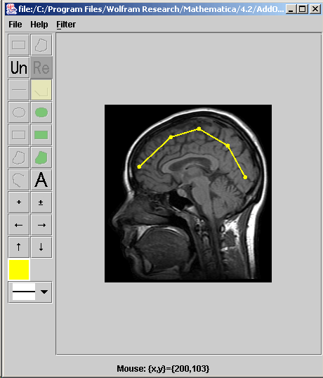 [Graphics:../HTMLFiles/index_364.gif]