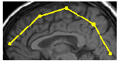[Graphics:../HTMLFiles/index_388.gif]