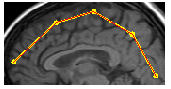 [Graphics:../HTMLFiles/index_395.gif]