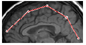 [Graphics:../HTMLFiles/index_410.gif]